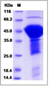 Human MAPT / Tau Recombinant Protein (His Tag)(Discontinued)