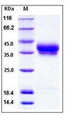 Human CD157 / BST1 Recombinant Protein (His Tag)(Discontinued)