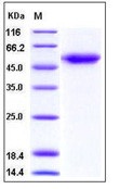 Human ALK-1 / ACVRL1 Recombinant Protein (Fc Tag)(Discontinued)