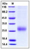 Human ALK-1 / ACVRL1 Recombinant Protein (His Tag)(Discontinued)