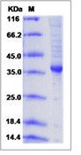 Human AGRP Recombinant Protein (Fc Tag)(Discontinued)