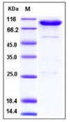 Human CD55 / DAF Recombinant Protein (Fc Tag)(Discontinued)