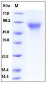 Human CD55 / DAF Recombinant Protein (His Tag)(Discontinued)