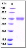 Human CD84 Recombinant Protein (His Tag)(Discontinued)