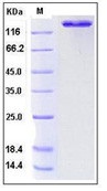 Human ACE2 / Angiotensin-Converting Enzyme 2 Recombinant Protein (Fc Tag)(Discontinued)