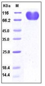 Human CD155 / PVR / NECL5 Recombinant Protein (Fc Tag)(Discontinued)