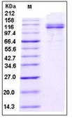 Human VCAM-1 / CD106 Recombinant Protein (Fc Tag)(Discontinued)