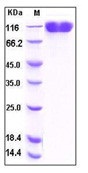 Human VCAM-1 / CD106 Recombinant Protein (His Tag)(Discontinued)