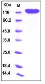 Human CD146 / MCAM Recombinant Protein (Fc Tag)(Discontinued)