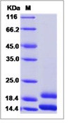 Human CCL2 / MCP-1 / MCP1 Recombinant Protein (His Tag)(Discontinued)