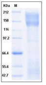 Human CD171 / N-CAML1 / L1CAM Recombinant Protein (His Tag)(Discontinued)