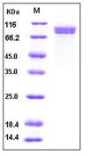 Human Cadherin-8 / CDH8 Recombinant Protein (His Tag)(Discontinued)