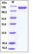 Human CD31 / PECAM1 Recombinant Protein (His Tag)(Discontinued)