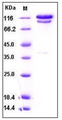 Human C2 / Complement Component 2 Recombinant Protein (Fc Tag)(Discontinued)