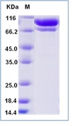 Human C2 / Complement Component 2 Recombinant Protein (His Tag)(Discontinued)