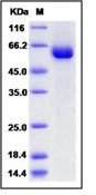 Human tPA / PLAT Recombinant Protein (Fc Tag)(Discontinued)