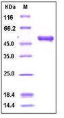 Human Cystatin 7 / CST7 Recombinant Protein (Fc Tag)(Discontinued)