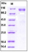 Human DR6 / TNFRSF21 Recombinant Protein (Fc Tag)(Discontinued)