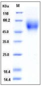 Human DR6 / TNFRSF21 Recombinant Protein (His Tag)(Discontinued)