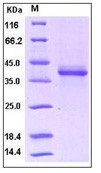 Human S100A1 Recombinant Protein (Fc Tag)(Discontinued)