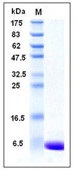 Human S100A1 Recombinant Protein(Discontinued)