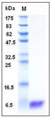 Human S100A2 Recombinant Protein(Discontinued)