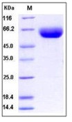 Human CD147 / EMMPRIN / Basigin Recombinant Protein (Fc Tag)(Discontinued)