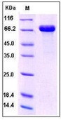 Human DC-SIGN / CD209 Recombinant Protein (Fc Tag)(Discontinued)