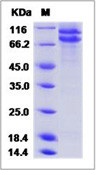 Human E-Cadherin / CDH1 / E-cad / CD324 Recombinant Protein (His Tag, ECD)(Discontinued)