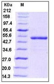 Human BMP-5 Recombinant Protein (Fc Tag)(Discontinued)