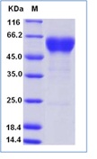 Human FAS / CD95 / APO-1 / TNFRSF6 Recombinant Protein (Fc Tag)(Discontinued)