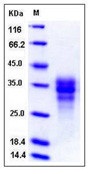 Human FAS / CD95 / APO-1 / TNFRSF6 Recombinant Protein (His Tag)(Discontinued)