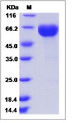 Human Erythropoietin / EPO Recombinant Protein (Fc Tag)(Discontinued)