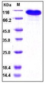 Human BCAM Recombinant Protein (Fc Tag)(Discontinued)