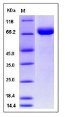 Human BCAM Recombinant Protein (His Tag)(Discontinued)