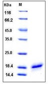 Human CD40L / CD154 / TNFSF5 Recombinant Protein (His Tag)(Discontinued)