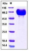 Human B7-DC / PD-L2 / CD273 Recombinant Protein (His & Fc Tag)(Discontinued)