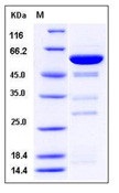 Human Galectin-8 / LGALS8 Recombinant Protein (GST Tag)(Discontinued)