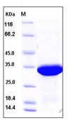 Human Galectin-8 / LGALS8 Recombinant Protein(Discontinued)