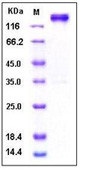 Human Leptin Receptor / LEPR / CD295 Recombinant Protein (His & Fc Tag)(Discontinued)