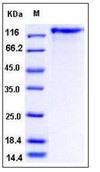 Human Leptin Receptor / LEPR / CD295 Recombinant Protein (His Tag)(Discontinued)