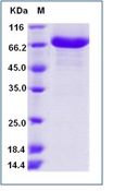 Human CD4 Recombinant Protein (Fc Tag)(Discontinued)