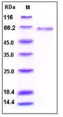 Human Alkaline Phosphatase / ALPL Recombinant Protein (His Tag)(Discontinued)