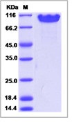 Human NCAM1 / CD56 Recombinant Protein (ECD, His Tag)(Discontinued)