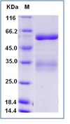 Human ANGPTL3 / Angiopoietin-like 3 Recombinant Protein (His Tag)(Discontinued)