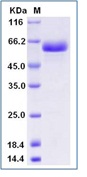 Human CD40 / TNFRSF5 Recombinant Protein (ECD, Fc Tag)(Discontinued)