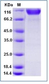 Human CD30 / TNFRSF8 Recombinant Protein (Fc Tag)(Discontinued)