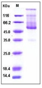 Human CD70 / CD27L / TNFSF7 Recombinant Protein (Fc Tag)(Discontinued)