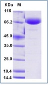 Human CD38 Recombinant Protein (Fc Tag)(Discontinued)