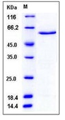 Human CDK5 Recombinant Protein (GST Tag)(Discontinued)